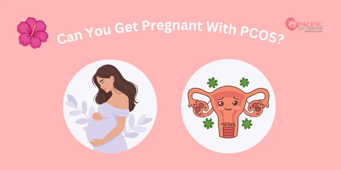 Can You Get Pregnant With PCOS